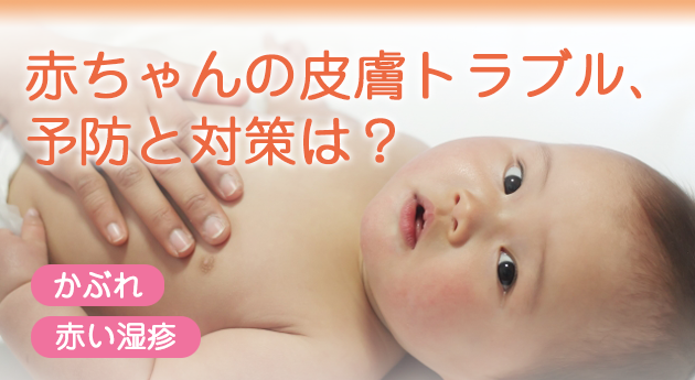 赤ちゃんの皮膚トラブル、予防と対策は？
